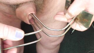 Foreskin five Episodes