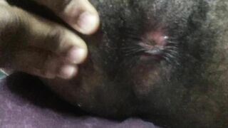 WOOLY PINKISH CREVASSE