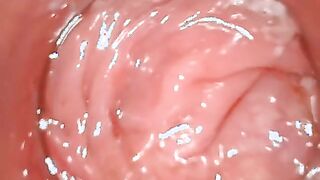 久しぶりにアナル　内視鏡してみたよ