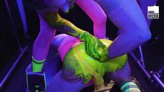 Axel Abysse Wedges His Fist And Beads Into Lawrence Knight