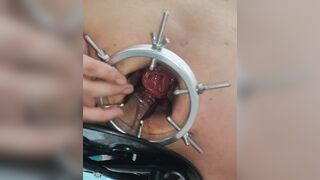 打开了我的肛门破坏他